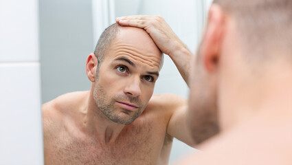 Obraz premium middle aged man looking at his bald head in the mirror, man's bald head 