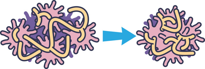 Medical illustration of clot retraction. Platelets contract the fibrin mesh, causing the blood clot to shrink and become more compact, aiding in hemostasis.