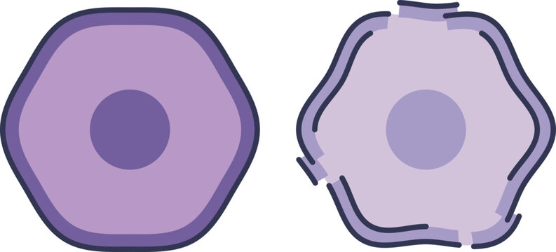 Illustration comparing a healthy pancreatic beta cell to a damaged one. The damaged cell shows a ruptured membrane, symbolizing cell death (apoptosis) and dysfunction in diabetes.