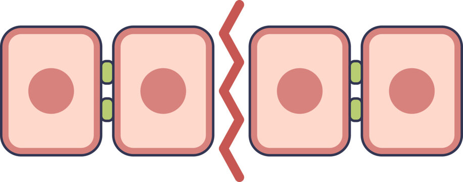 Illustration of a tight junction leak. Epithelial cells are separated, showing a compromised intestinal barrier, a key aspect of leaky gut syndrome.