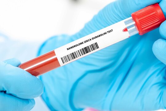 Nandrolone (Deca-Durabolin) Test
