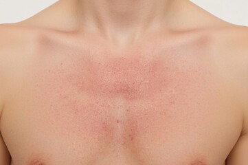 Naklejka premium Close-up of reddened chest skin