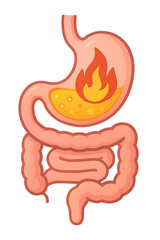 Illustration of stomach with heartburn and acid reflux isolated on transparent background, depicting digestive system issues and related health problems