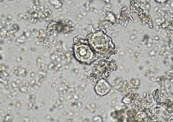 soil microorganisms under a microscope including amoeba, flagellates, nematodes, fungi, bacteria	