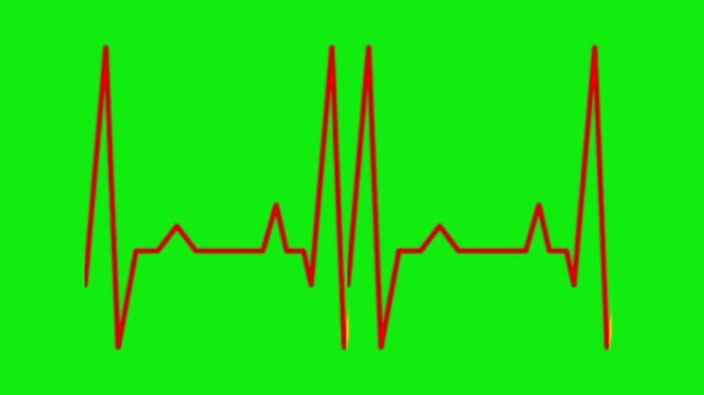  Green Screen ECG Lines Heartbeat