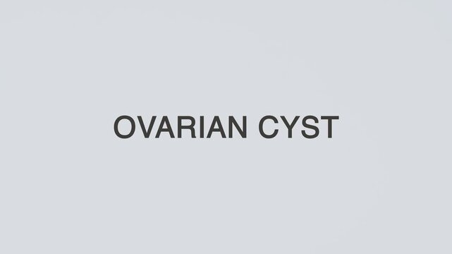 Ovarian cyst word diagnosed with hand holding stethoscope on white background, illustrating gynecology, reproductive health, pelvic mass, diagnosis, and treatment