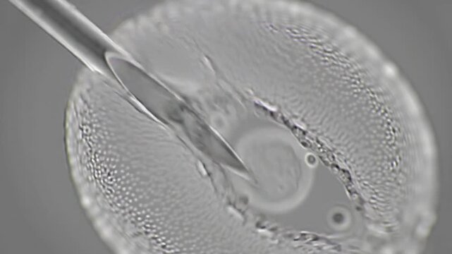 Close Up of Microscopic Intracytoplasmic Sperm Injection ICSI Process on Egg Cell Surrounded by Protective Layers a Key Fertility Treatment and Reproductive Technology