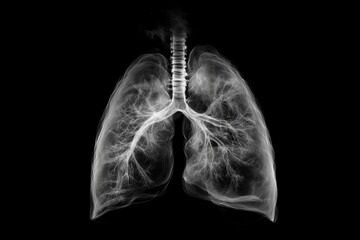 Imaging the human lung with chronic obstructive disease, the concept of health and disease