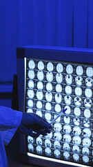 Doctor and MRI. MRI of the brain. Doctor. High-quality photo.