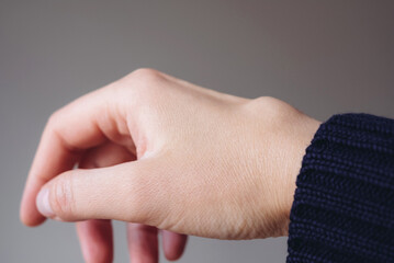 Female right back hand with ganglion cyst on the dorsum,  fluid-filled bump associated with a joint or tendon sheath, close-up view, selected focus.