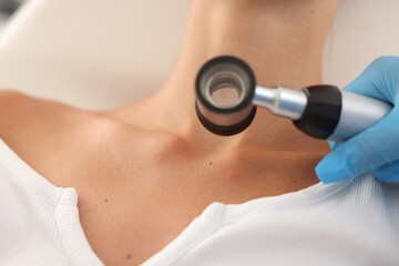 Doctor examining young woman's mole with dermatoscope in hospital, closeup