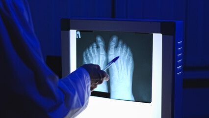 Radiologist. X-ray close-up. X-ray of two feet. High-quality photo.