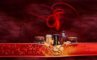 Concept of fast food, sugar, and alcohol leading to atherosclerosis, LDL cholesterol buildup, clogged arteries, cardiovascular disease, stroke, and fatal heart attacks  body system. 3D rendering