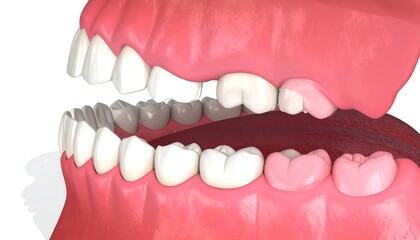 3D illustration of misaligned teeth with varying shades, showcasing dental imperfections.