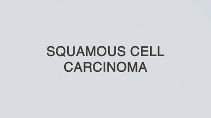 Squamous cell carcinoma concept word stethoscope illustrative illustration text hand diagnosed on white background for skin health awareness, patient care, and medical evaluation
