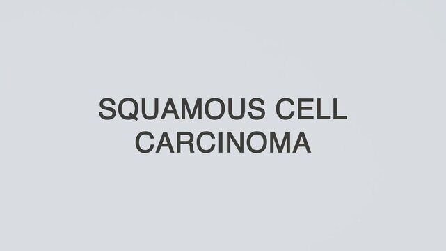 Squamous cell carcinoma concept word stethoscope illustrative illustration text hand diagnosed on white background for skin health awareness, patient care, and medical evaluation