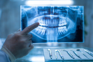 Dentist examining a detailed dental x-ray highlighting teeth and jaw structure with dental tools in the foreground