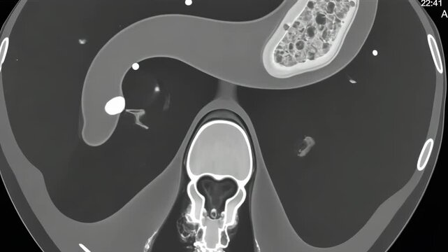 stomach scan, abdominal imaging, organ diagnostics. Digestive health. Intestines absorb essential nutrients. Gastric lining resists acid damage. Pancreatic function supports metabolism.