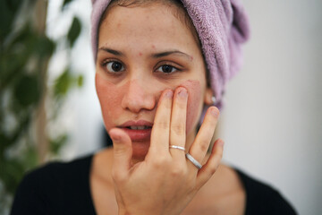 A young woman with a towel on her head applies a reddish face mask to her skin. She is focused on her skincare routine, promoting healthy skin and self-care.