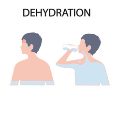 Dehydration vector illustration showing dry mouth, dizziness, fatigue, dark urine, rapid heartbeat; highlights symptoms similar to heatstroke, flu, and food poisoning.water
