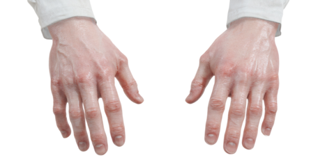 Two pale hands, palms up, appear to be positioned in a neutral or relaxed posture.  Skin texture is detailed, showing creases and lines.  Hands are isolated on a black background