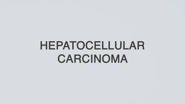 Hepatocellular carcinoma concept word hand holding stethoscope on white background for liver monitoring, cancer diagnosis, treatment, prevention, wellness, and medical awareness