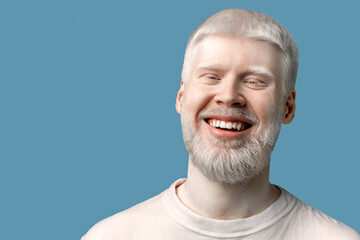 Portrait of happy bearded albino man with pale skin and white hair wearing t-shirt, posing and smiling to camera on turquoise studio background. Abnormal deviations, unusual appearance