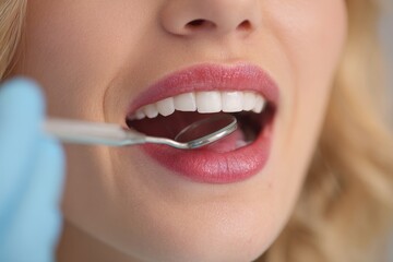 Fototapeta premium Partial close up of a blonde woman during a dental exam