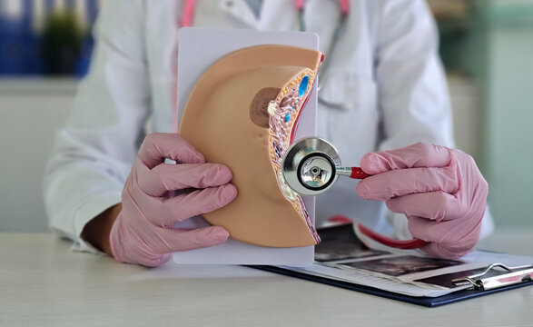 Female doctor explains the disease using an anatomical model of breast. Diagnosis of mammalogical diseases - Powered by Adobe