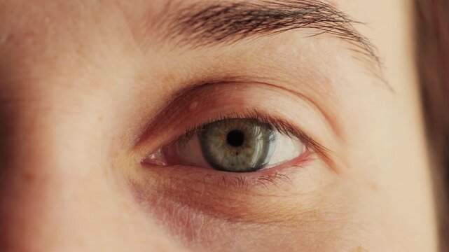 Close-up of a watery eye with green iris. Female face footage.