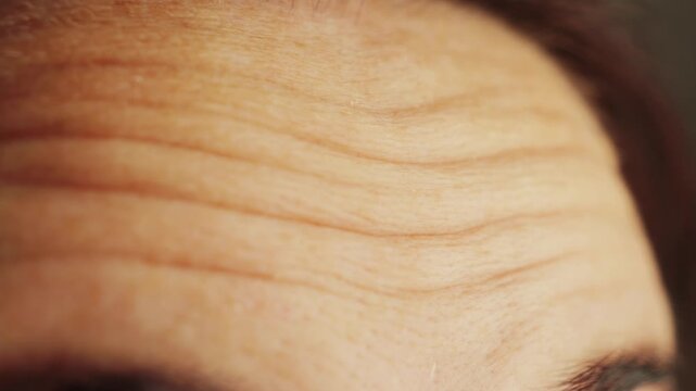 Close-up of a woman's forehead with wrinkles, woman looks surprised and wrinkles her forehead.