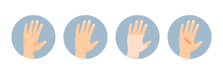 Obraz premium Various hand injuries. Psoriasis, fracture, cut and healthy hand. Hand skin problems.