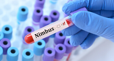 Obraz premium Doctor in protective uniform holding a blood test tube labeled Nimbus NB.1.8.1 with background of laboratory test tubes, symbolizing analysis of new dangerous coronavirus strain with severe symptoms