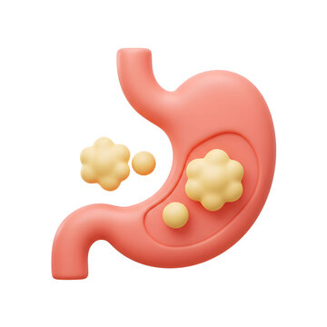 Stomach Health: 3D Illustration of Gastric Issues