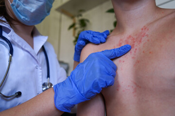 A doctor in blue gloves examines the rash on the boy's body.