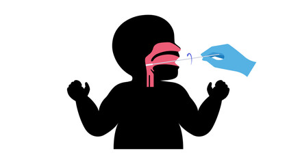 Swab throat procedure