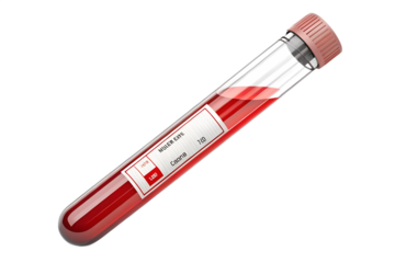 Blood sample in test tube for medical examination