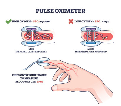 Pulse oximeter diagram shows how a fingertip device measures blood oxygen levels using light absorption. Key objects, finger, sensor, blood vessel. Outline diagram