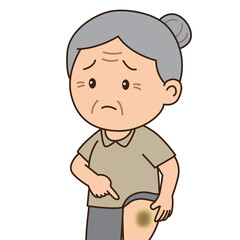 An elderly woman points to her bruised knee from a slip and fall accident, illustration cartoon on white background