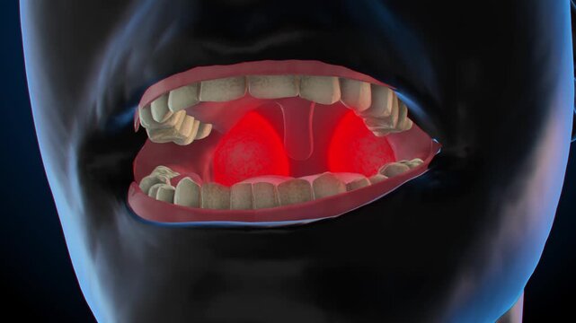x ray image of teeth