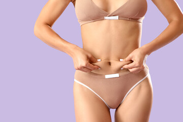 Young woman in underwear with cellulite problem on lilac background