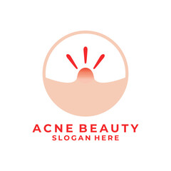 Acne circle logo design vector template. Acne icon logo