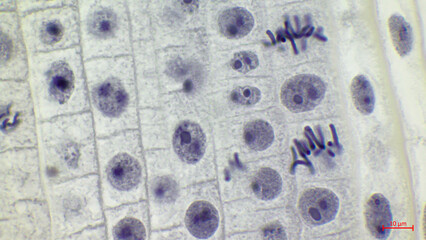 Onion root tip mitosis under light microscope. Cells of Allium cepa in different stages of nuclear...