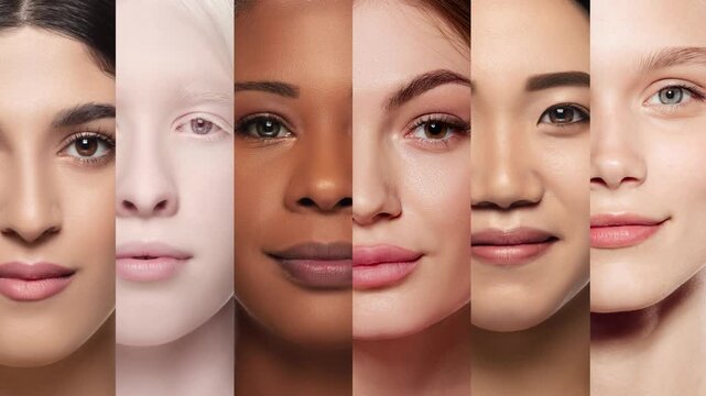 Medical and dermatological materials on skin conditions. Video banner. Close-up of young girls of different nationality and skin colors. Concept of human diversity, beauty standards, cosmetics