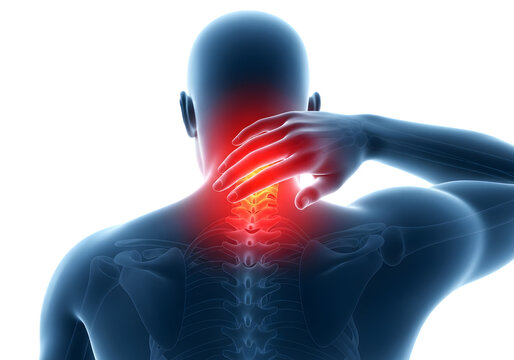Neck Pain Spine Anatomy Medical Illustration Cut Out PNG.