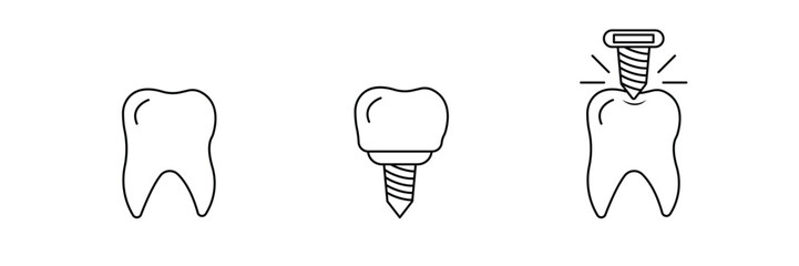 Dental care implant, tooth prosthetics treatment, oral hygiene health, dentist equipment symbol, medical surgery procedure outline, stomatology clinic icon vector illustration.