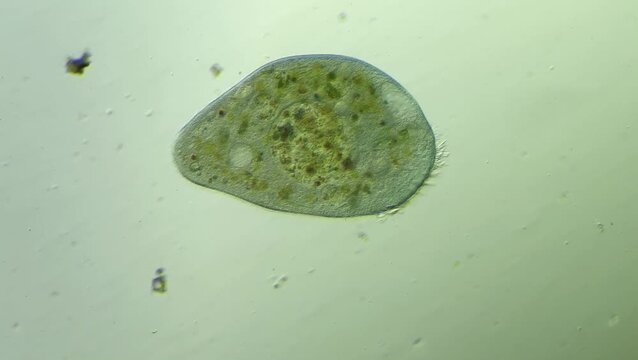 Microbe Stentor  under microscope at 100x magnification