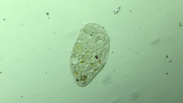 Microbe Stentor  under microscope at 100x magnification