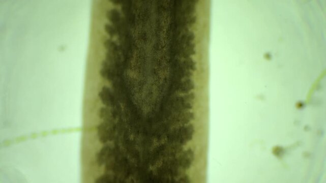Planarian under the microscope at 40x Magnification