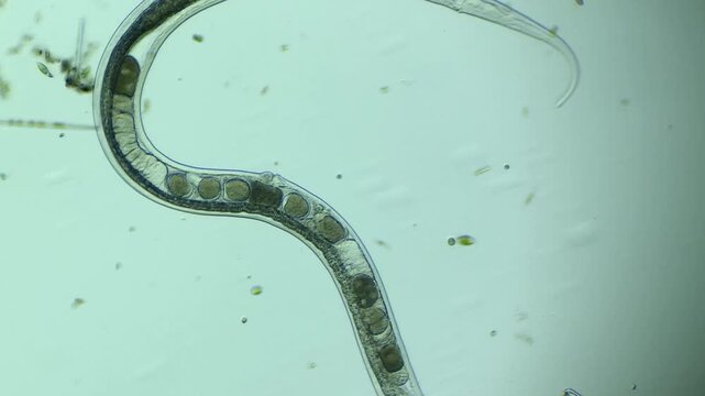Microscopic View of Nematode roundworm at 100x Magnification